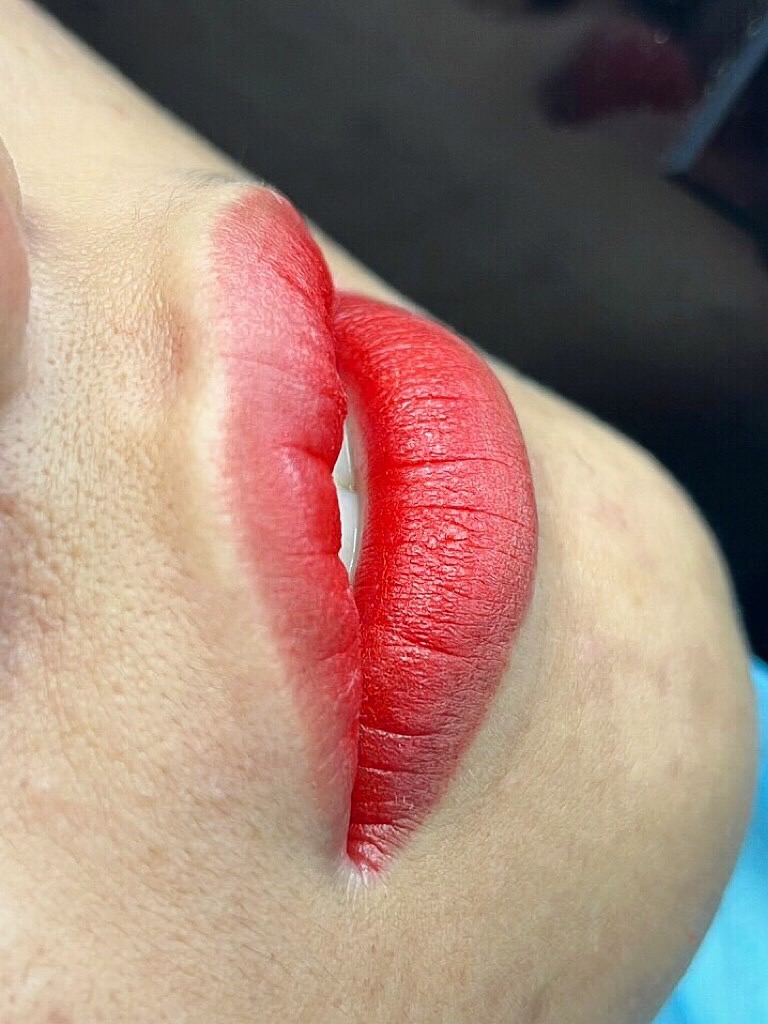 Lippenpigmentierung